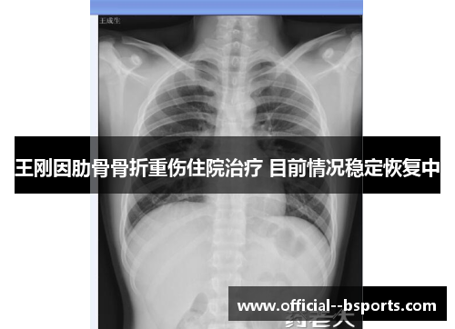 王刚因肋骨骨折重伤住院治疗 目前情况稳定恢复中